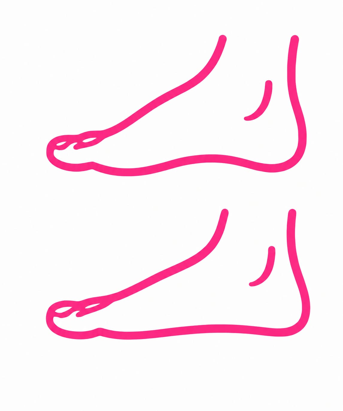 Fascitis plantar