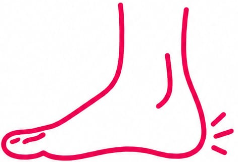 Fascitis plantar