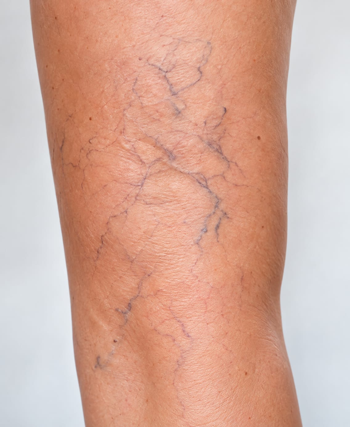 Venas reticulares