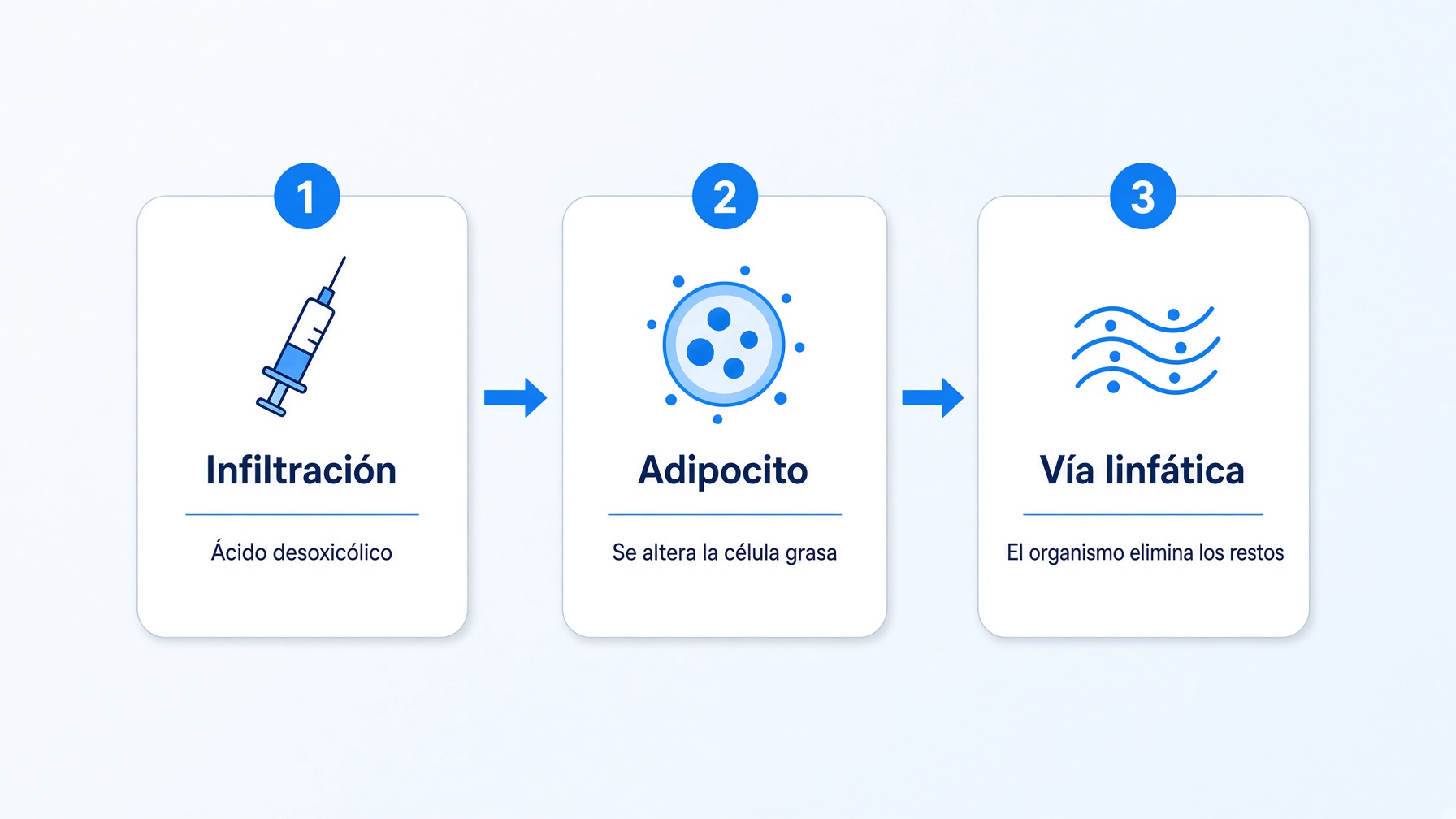 Esquema de cómo actúa la intralipoterapia: infiltración de ácido desoxicólico en la grasa subcutánea, alteración del adipocito y eliminación por vía linfática